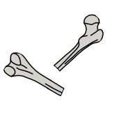 Drawing of two broken white animal bones